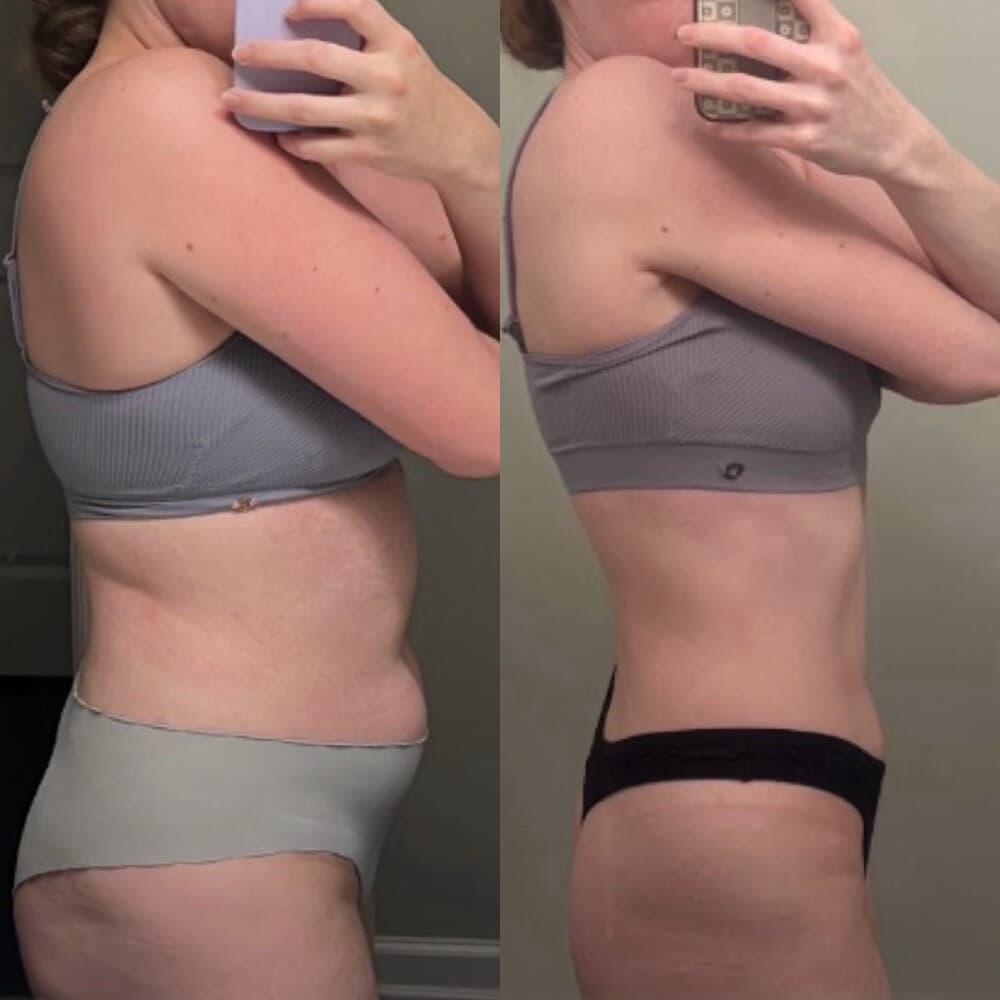 Client before and after, 4 of 6